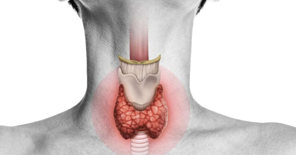Opções de tratamento para Hipotireoidismo: escolhendo o caminho certo